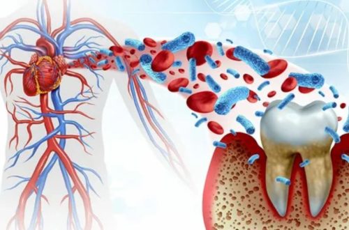 Can Disohozid Disease Kill You? What to Know