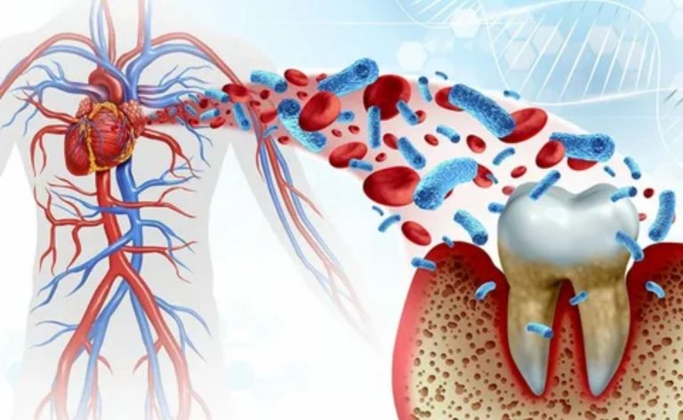 Can Disohozid Disease Kill You? What to Know